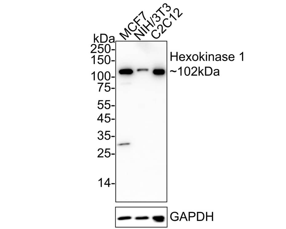 Hexokinase 1 Antibody (ST47-05) Western Blot: Hexokinase 1 Antibody (ST47-05) [NBP2-67503]