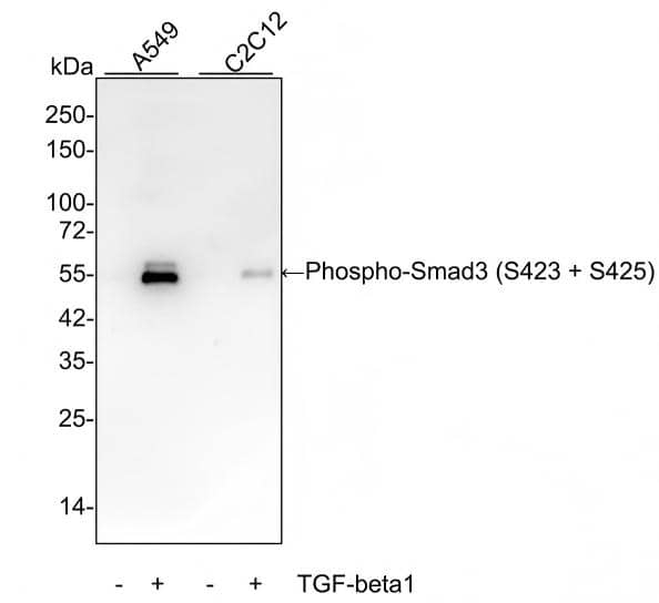 Smad3 [p Ser423, p Ser425] Antibody (ST0493) Western Blot: Smad3 [p Ser423, p Ser425] Antibody (ST0493) [NBP2-67513]