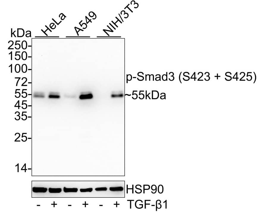 Smad3 [p Ser423, p Ser425] Antibody (ST0493) Western Blot: Smad3 [p Ser423, p Ser425] Antibody (ST0493) [NBP2-67513]