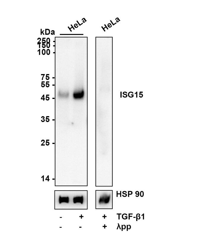 Smad3 [p Ser423, p Ser425] Antibody (ST0493) Western Blot: Smad3 [p Ser423, p Ser425] Antibody (ST0493) [NBP2-67513]