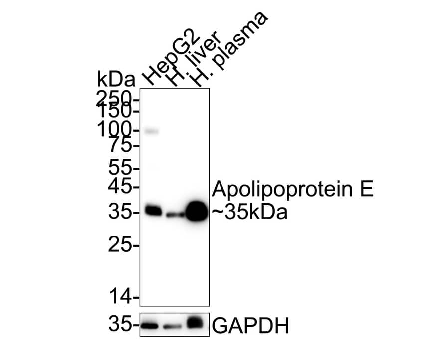 Apolipoprotein E/ApoE Antibody (SC0536) Western Blot: Apolipoprotein E/ApoE Antibody (SC0536) [NBP2-67565]
