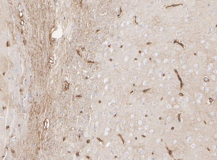 Apolipoprotein E/ApoE Antibody (SC0536)