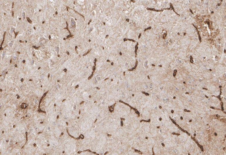 Apolipoprotein E/ApoE Antibody (SC0536)