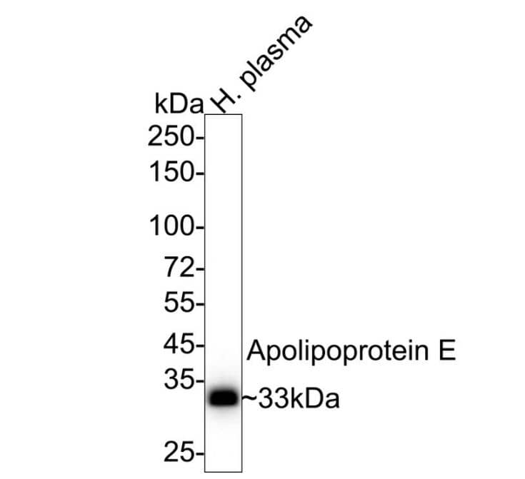 Apolipoprotein E/ApoE Antibody (SC0536)