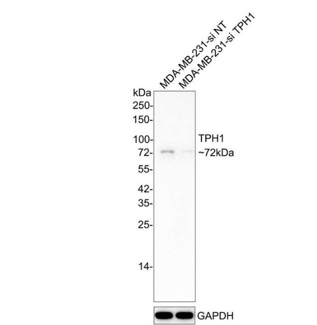 Tryptophan Hydroxylase 1/TPH-1 Antibody (SC53-07)