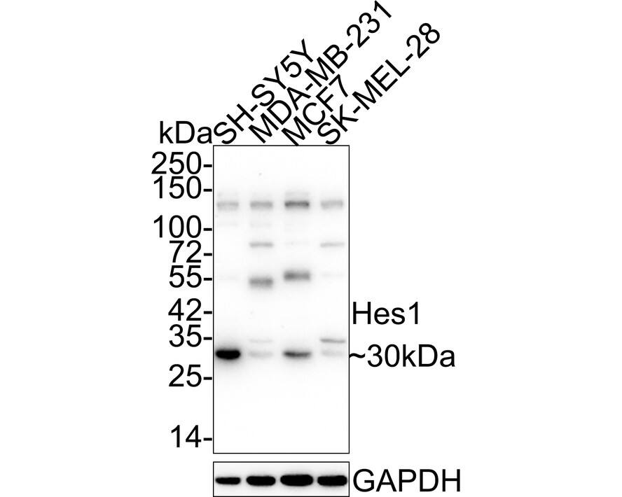 HES-1 Antibody (SC06-21) Western Blot: HES-1 Antibody (SC06-21) [NBP2-67642]