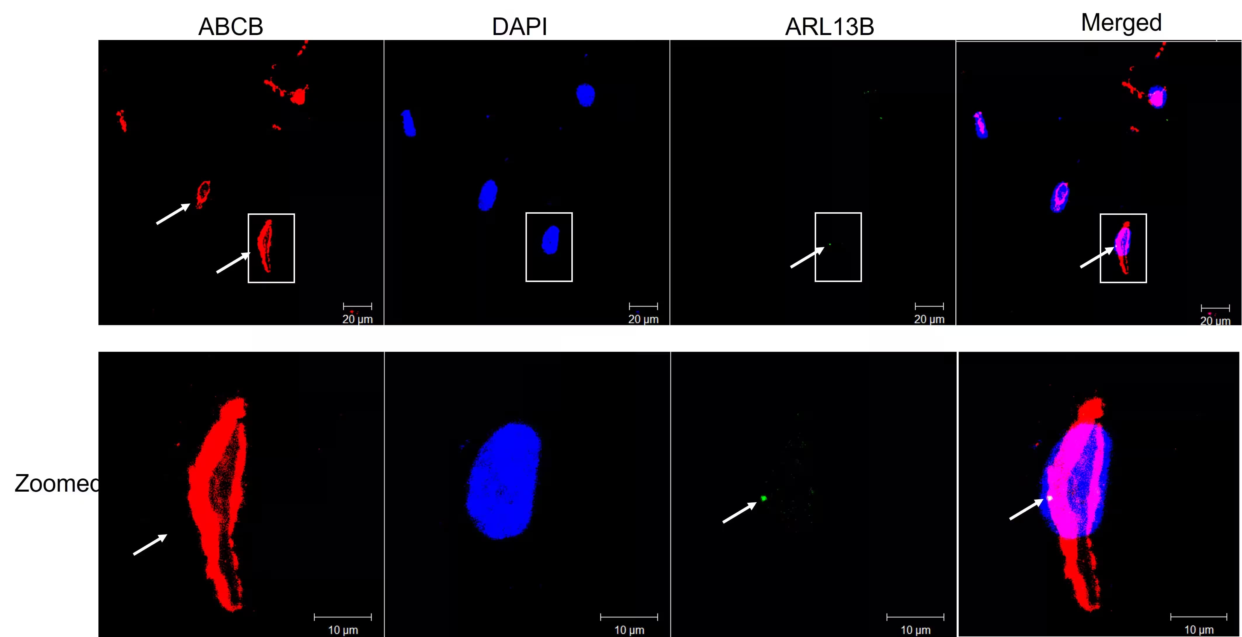 MDR1/ABCB1 Antibody (SN06-42)