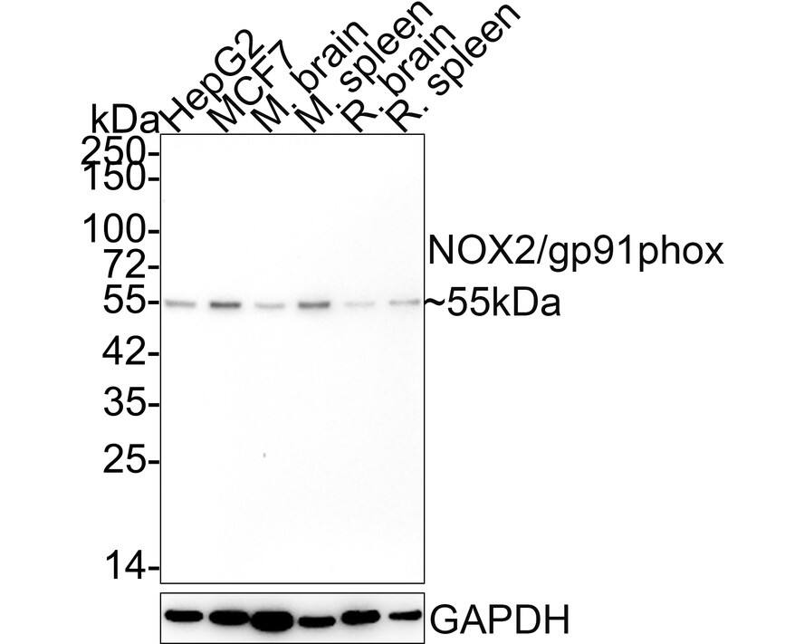 CYBB/NOX2 Antibody (SN07-16) Western Blot: CYBB/NOX2 Antibody (SN07-16) [NBP2-67680]