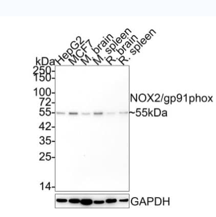 CYBB/NOX2 Antibody (SN07-16)