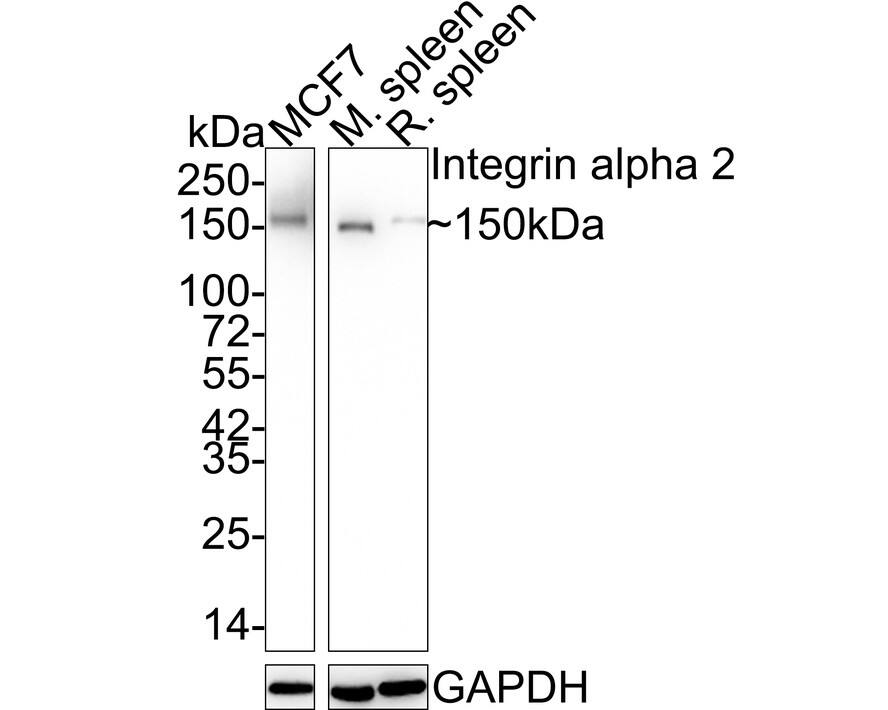 Integrin alpha 2/CD49b Antibody (SN0752) Western Blot: Integrin alpha 2/CD49b Antibody (SN0752) [NBP2-67691]