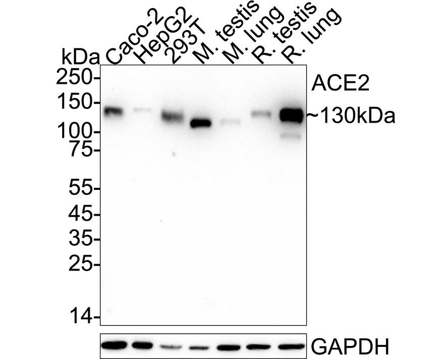 ACE-2 Antibody (SN0754) Western Blot: ACE-2 Antibody (SN0754) [NBP2-67692]