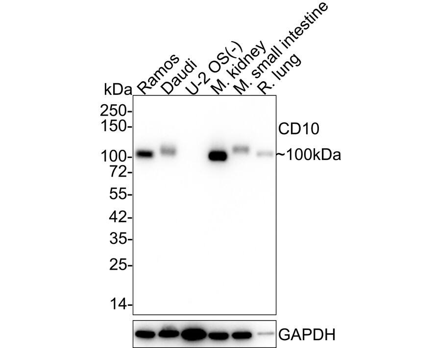 Neprilysin/CD10 Antibody (SN75-07) Western Blot: Neprilysin/CD10 Antibody (SN75-07) [NBP2-67717]
