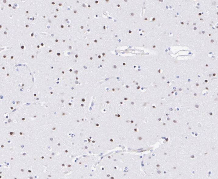 SOX1 Antibody (JJ20-40)