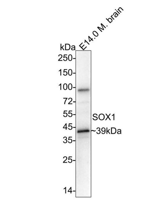 SOX1 Antibody (JJ20-40)