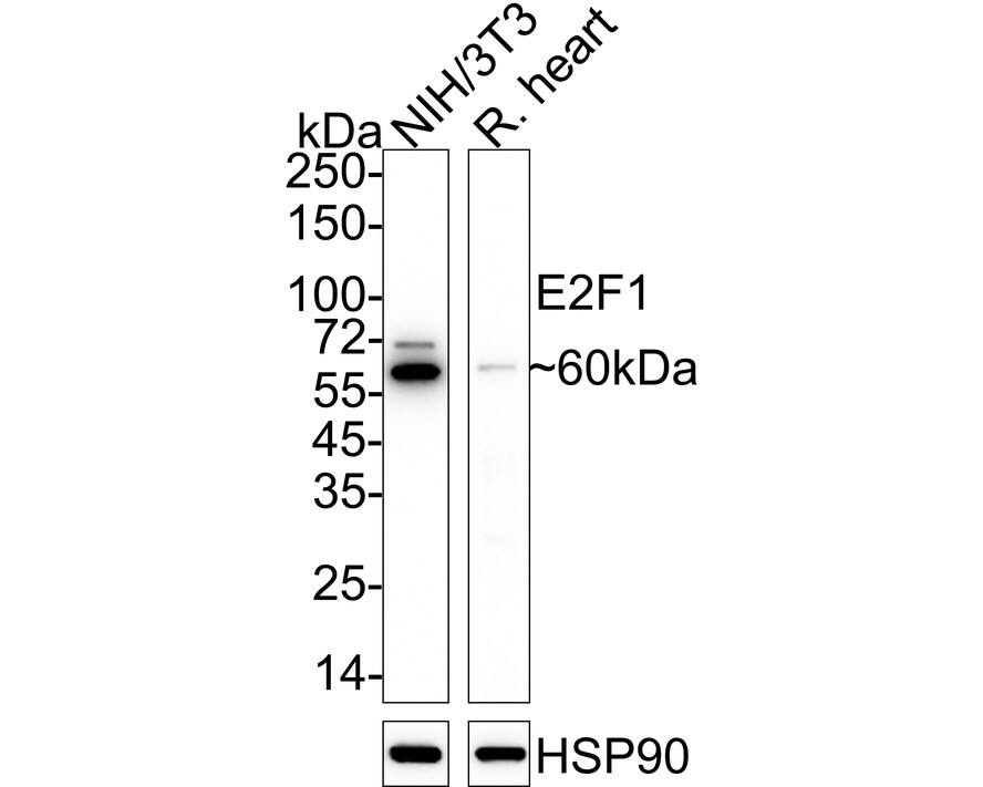 E2F-1 Antibody (JJ092-02) Western Blot: E2F-1 Antibody (JJ092-02) [NBP2-67899]