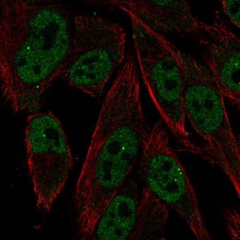 RXR gamma/NR2B3 Antibody - BSA Free Immunocytochemistry/ Immunofluorescence: RXR gamma/NR2B3 Antibody [NBP2-68585]