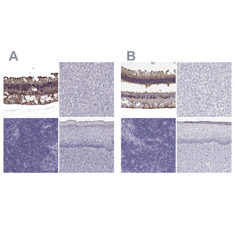 CRALBP Antibody Immunohistochemistry-Paraffin: CRALBP Antibody Antibody [NBP2-68644]