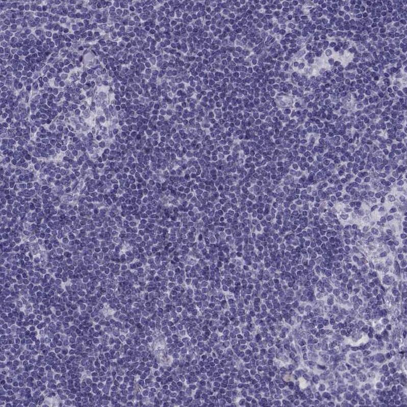 CRALBP Antibody Immunohistochemistry-Paraffin: CRALBP Antibody [NBP2-68644]
