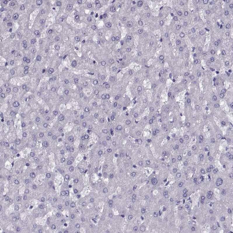 CRALBP Antibody Immunohistochemistry-Paraffin: CRALBP Antibody [NBP2-68644]
