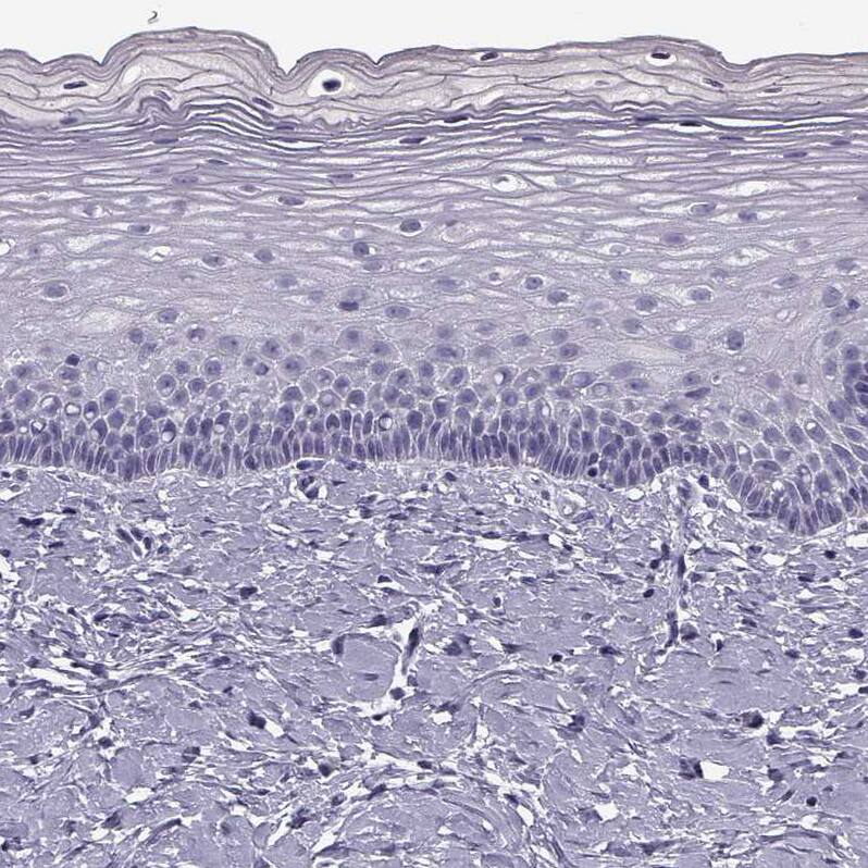 CRALBP Antibody Immunohistochemistry-Paraffin: CRALBP Antibody [NBP2-68644]