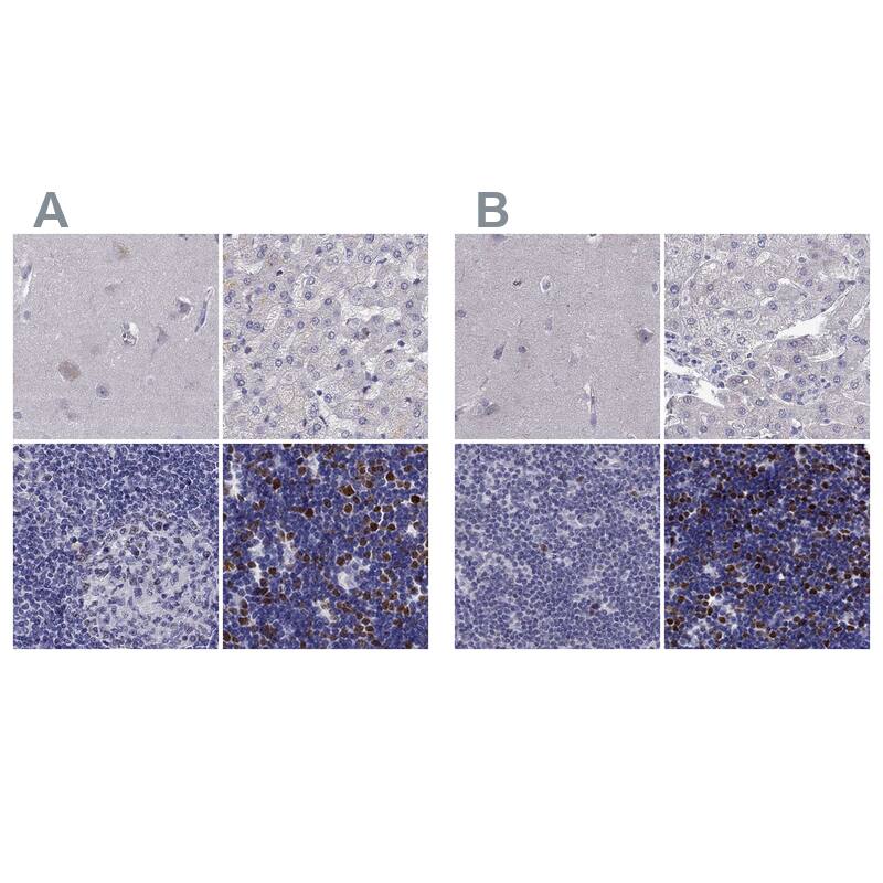 UHRF1 Antibody Immunohistochemistry-Paraffin: UHRF1 Antibody Antibody [NBP2-68720]