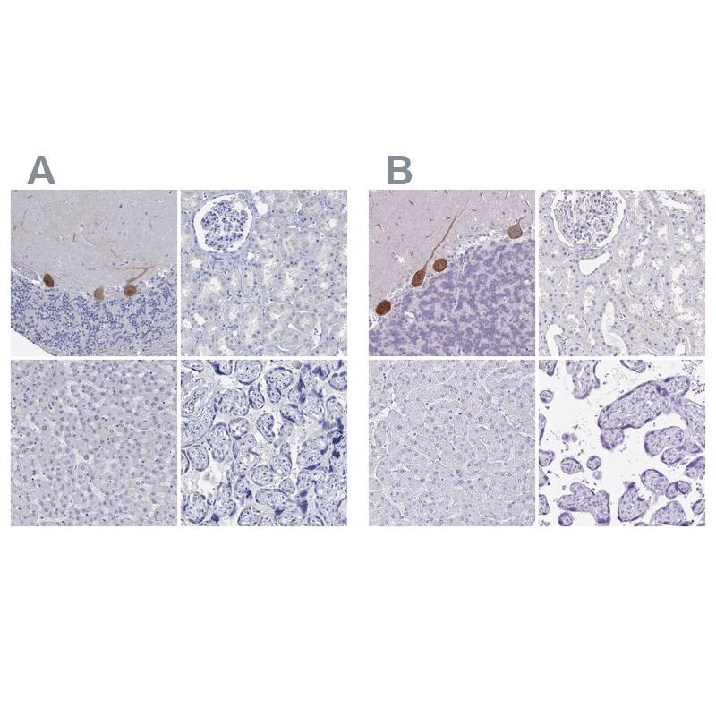 G-substrate Antibody Immunohistochemistry-Paraffin: G-substrate Antibody Antibody [NBP2-68949]