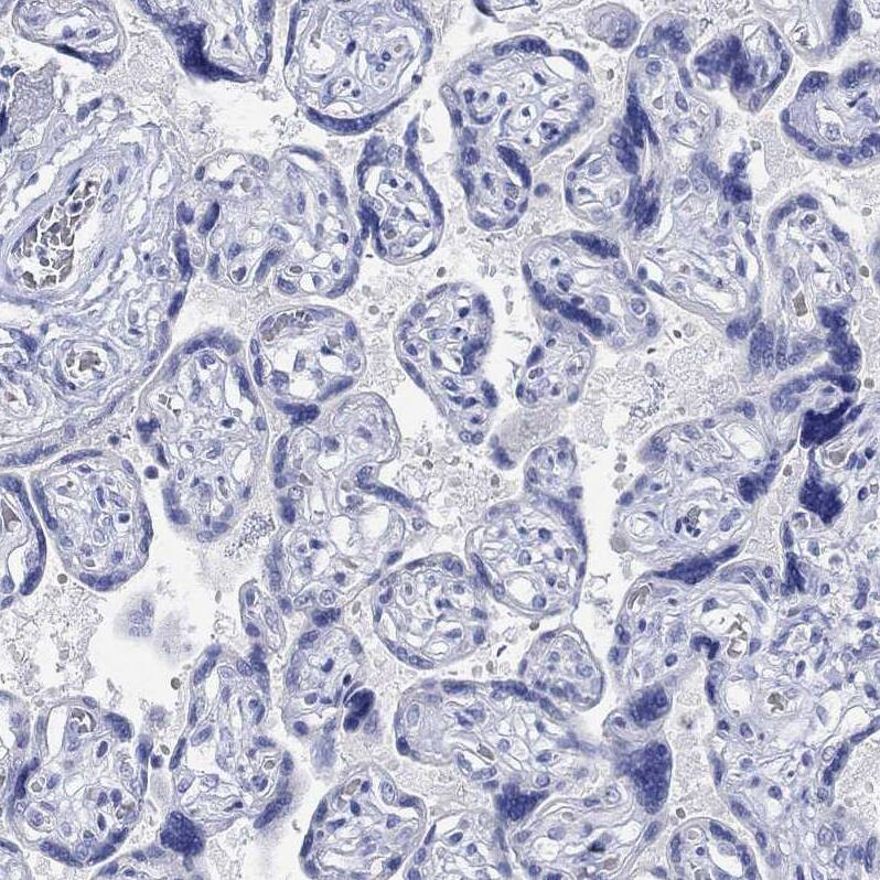G-substrate Antibody Immunohistochemistry-Paraffin: G-substrate Antibody [NBP2-68949]