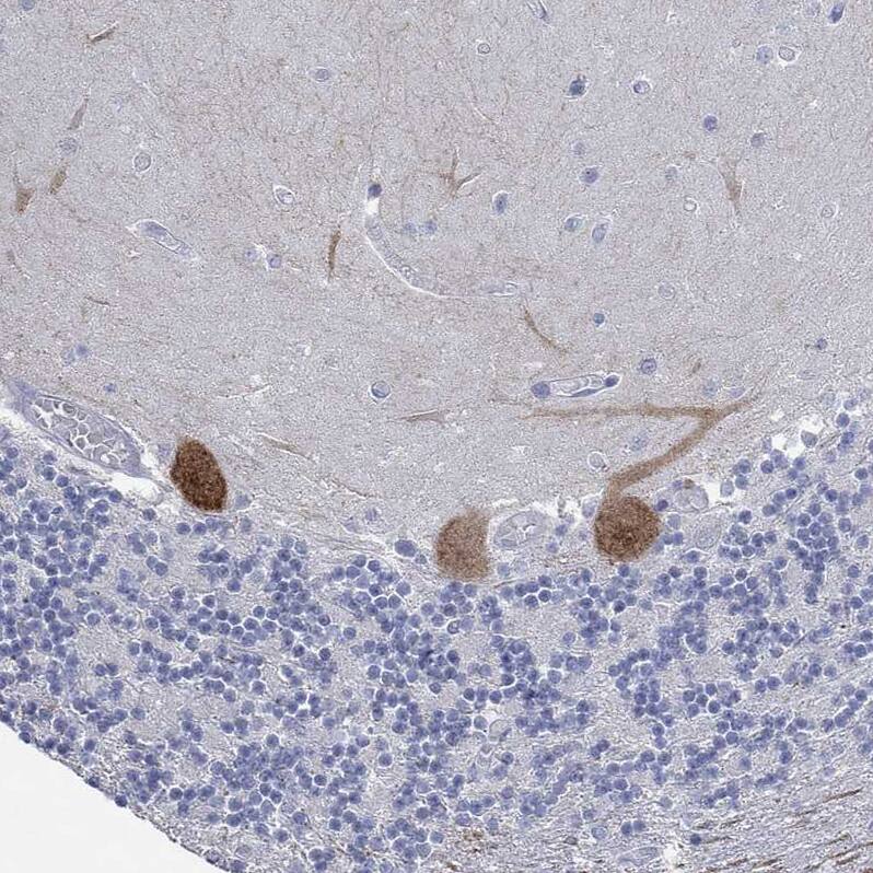 G-substrate Antibody Immunohistochemistry-Paraffin: G-substrate Antibody [NBP2-68949]