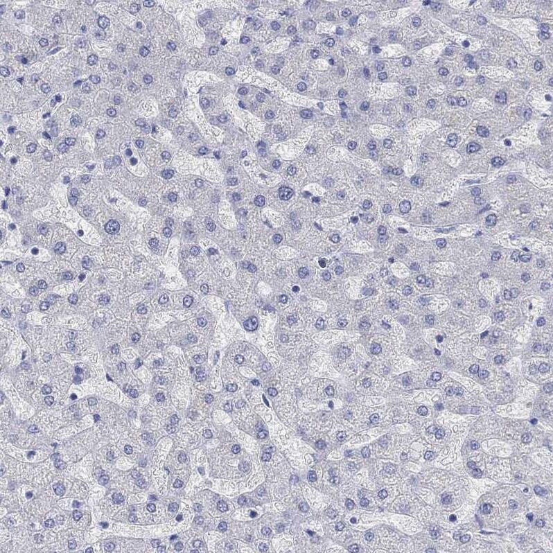 G-substrate Antibody Immunohistochemistry-Paraffin: G-substrate Antibody [NBP2-68949]
