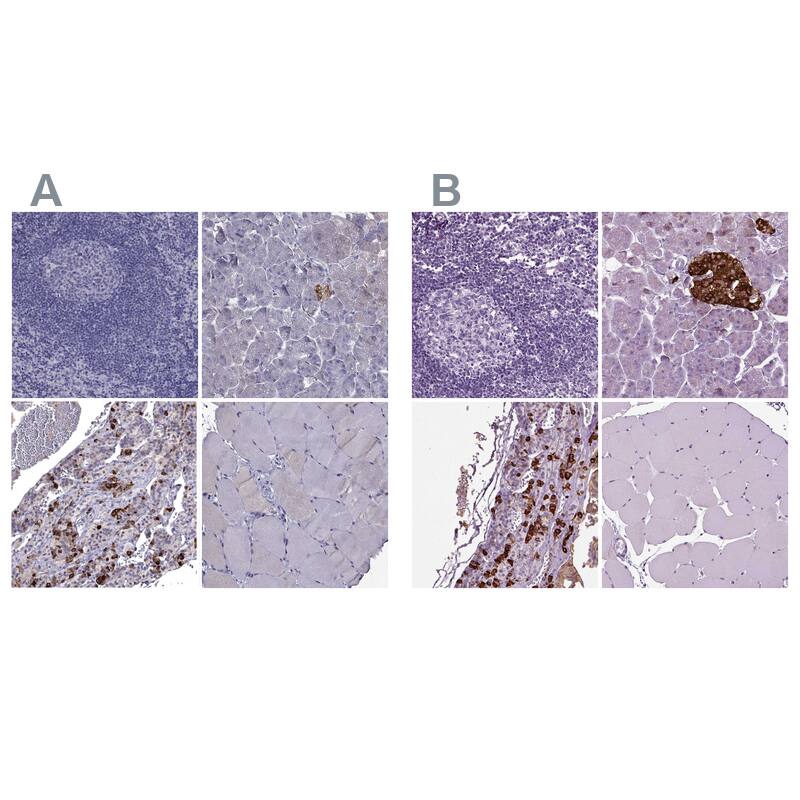 Secretogranin V Antibody Immunohistochemistry-Paraffin: Secretogranin V Antibody Antibody [NBP2-68983]