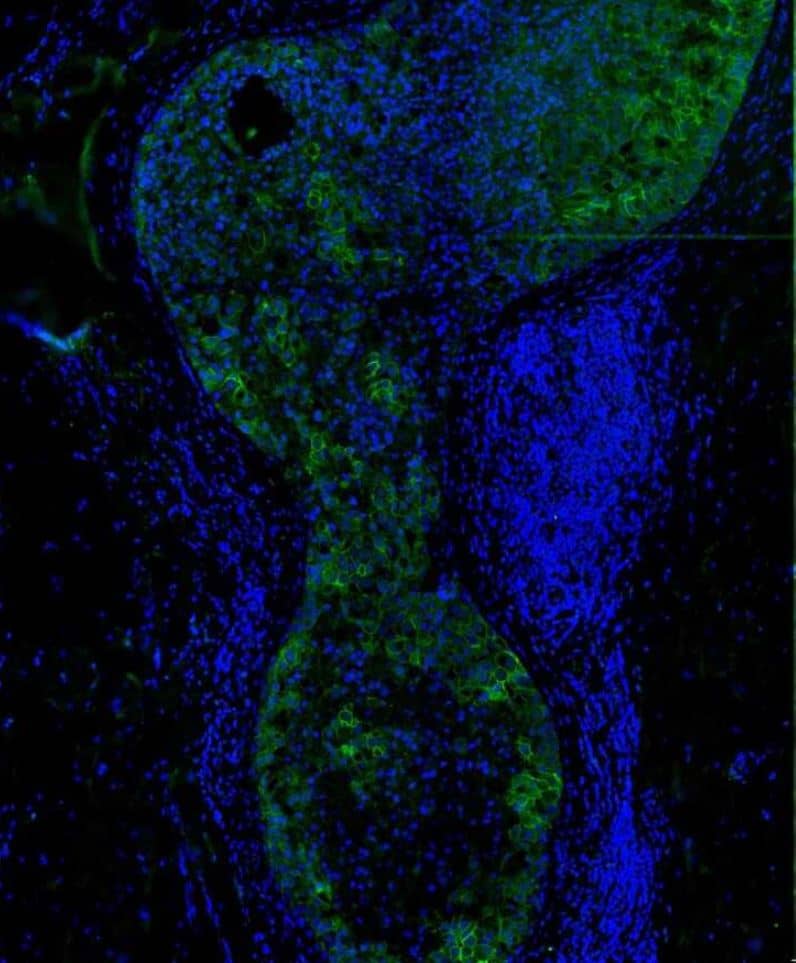 Carbonic Anhydrase XII/CA12 Antibody (OTI2C6) [FITC]