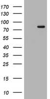 DNA Polymerase iota Antibody (OTI1H9)