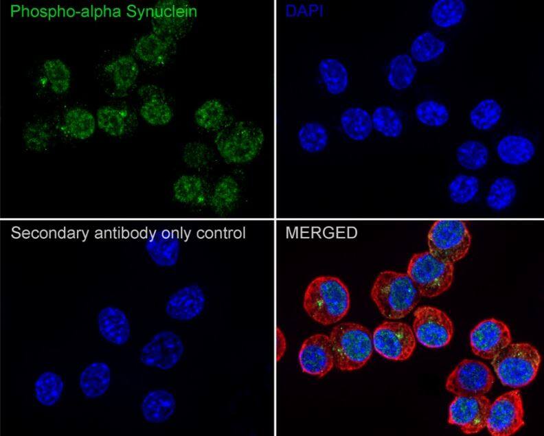 JF3007 SIDE ANTIBODY バロン・ズゥ ブレンパワード バロンズゥ | ブレンパワード | RoboInfo 機器人作品資訊網