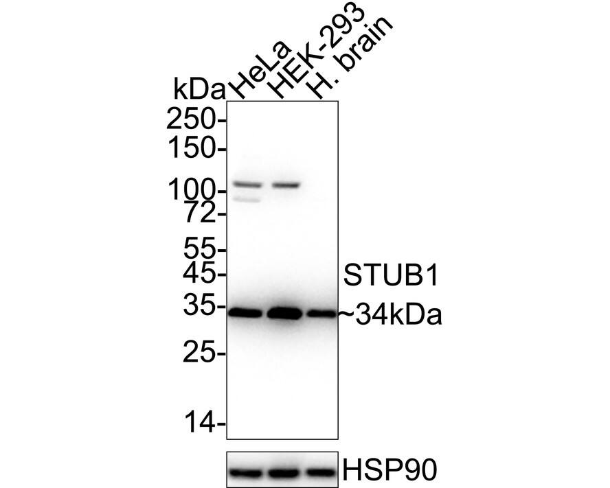 CHIP/STUB1 Antibody (JG38-22) Western Blot: CHIP/STUB1 Antibody (JG38-22) [NBP2-75440]