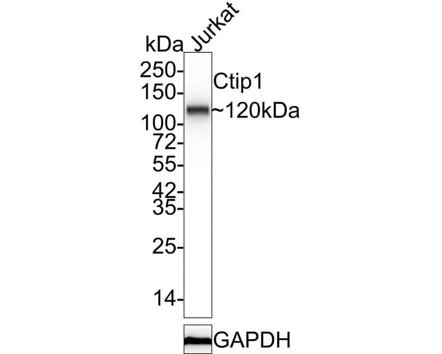Ctip1 Antibody (JB35-68) Western Blot: Ctip1 Antibody (JB35-68) [NBP2-75455]