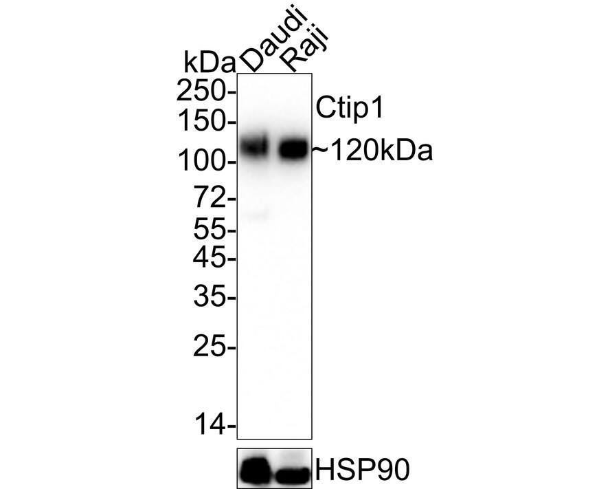 Ctip1 Antibody (JB35-68) Western Blot: Ctip1 Antibody (JB35-68) [NBP2-75455]