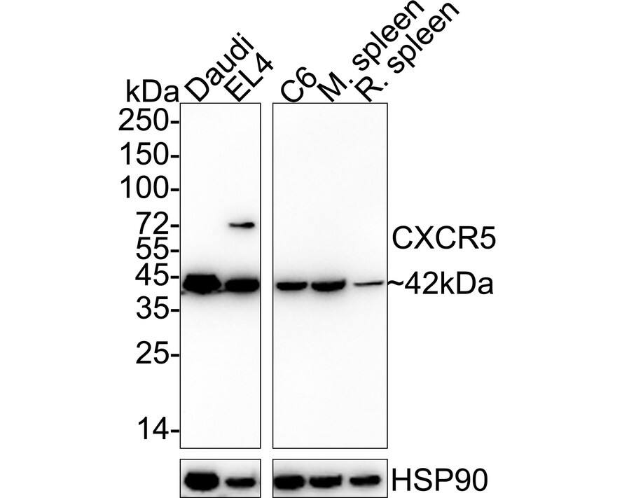 CXCR5 Antibody (JB11-40) Western Blot: CXCR5 Antibody (JB11-40) [NBP2-75460]