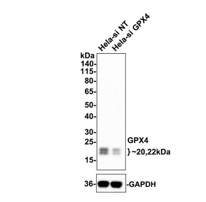 Glutathione Peroxidase 4/GPX4 Antibody (JU11-31)