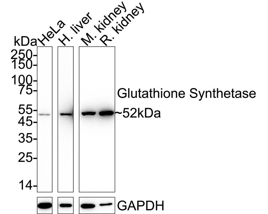 Glutathione Synthetase Antibody (JB95-33) Western Blot: Glutathione Synthetase Antibody (JB95-33) [NBP2-75513]