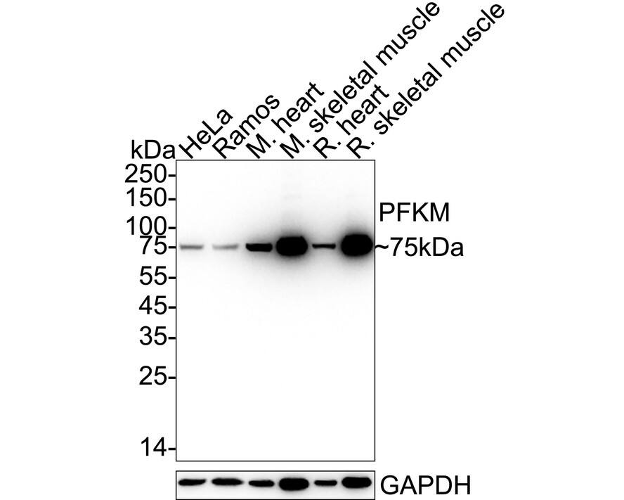 Muscle Phosphofructokinase/PFKM/PFK-1 Antibody (JU53-31) Western Blot: Muscle Phosphofructokinase/PFKM/PFK-1 Antibody (JU53-31) [NBP2-75578]