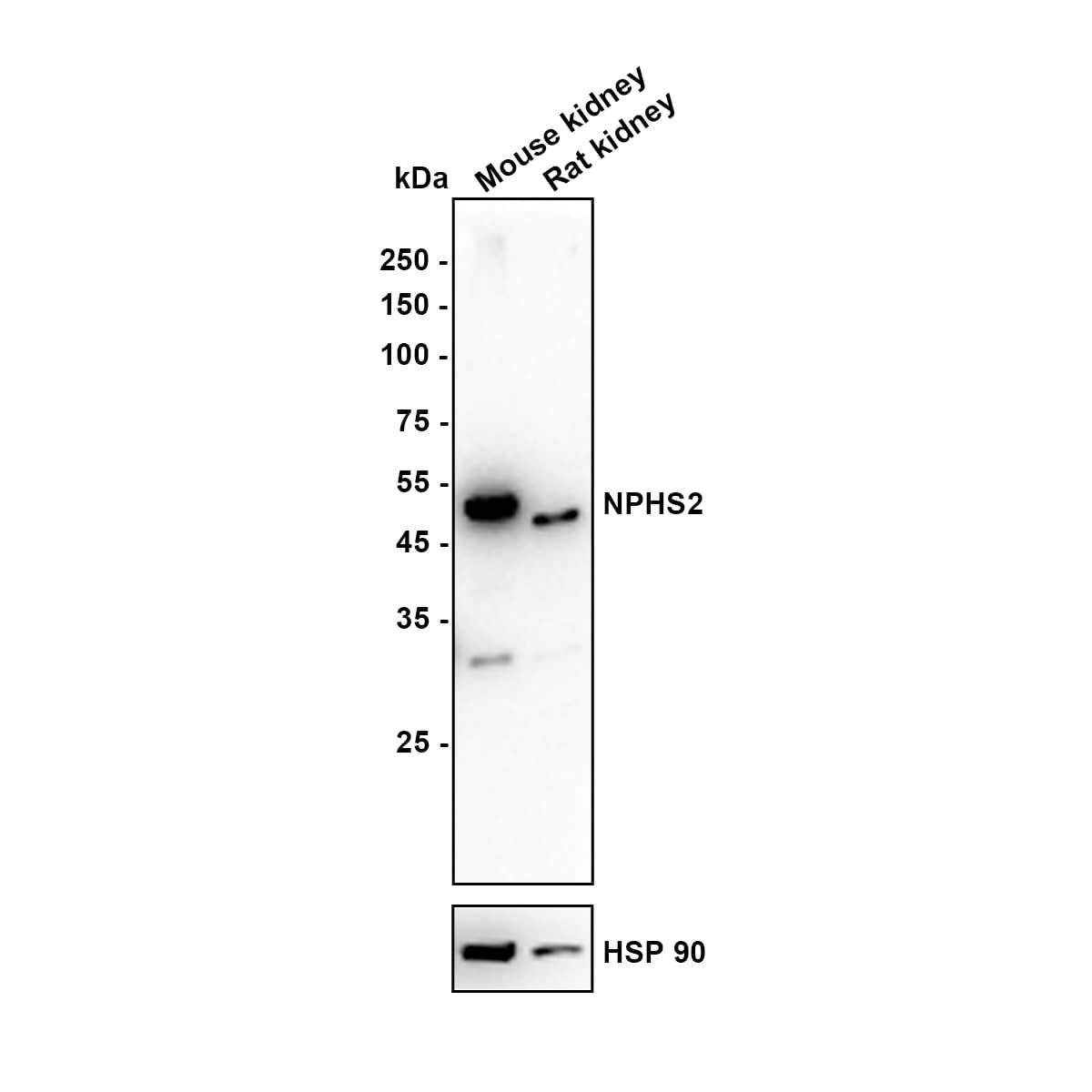 Podocin/NPHS2 Antibody (JB51-33) Western Blot: Podocin/NPHS2 Antibody (JB51-33) [NBP2-75624]