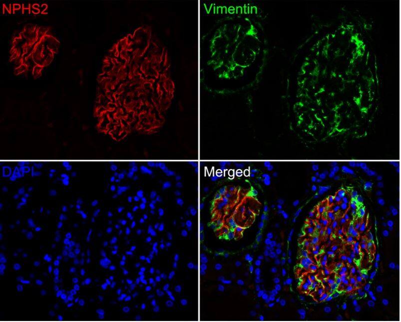 Podocin/NPHS2 Antibody (JB51-33)