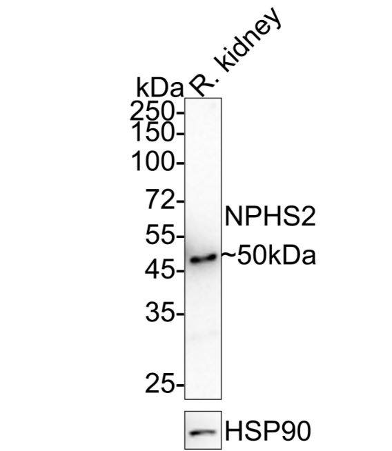 Podocin/NPHS2 Antibody (JB51-33)