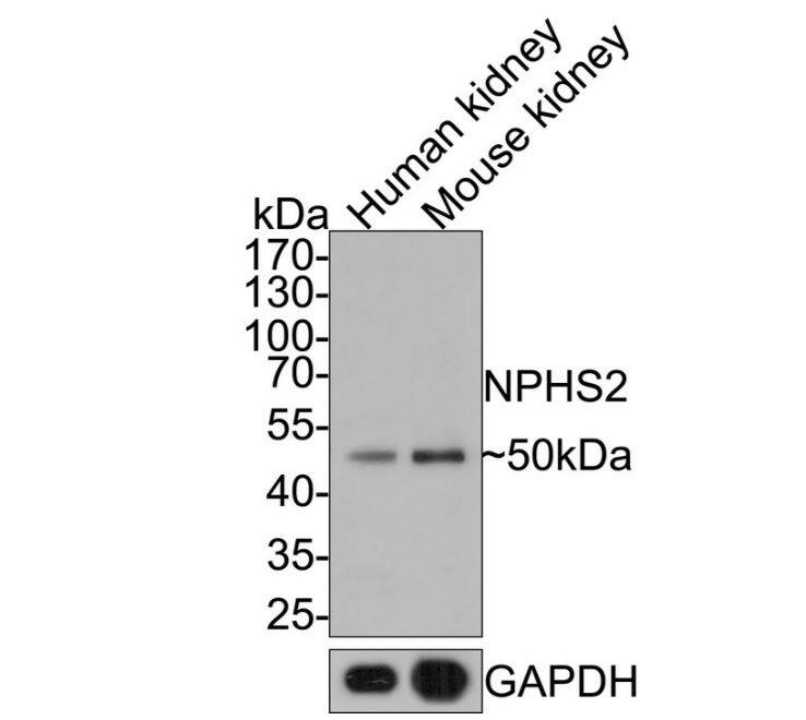 Podocin/NPHS2 Antibody (JB51-33)