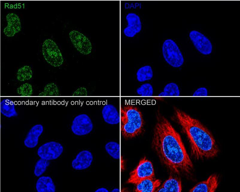 Rad51 Antibody (JM54-26)