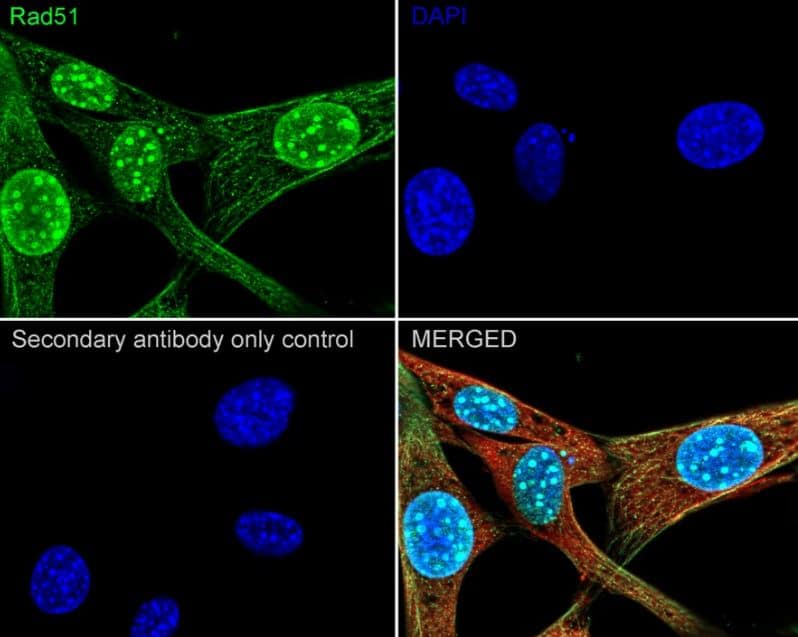 Rad51 Antibody (JM54-26)