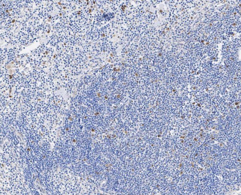 Rad51 Antibody (JM54-26)