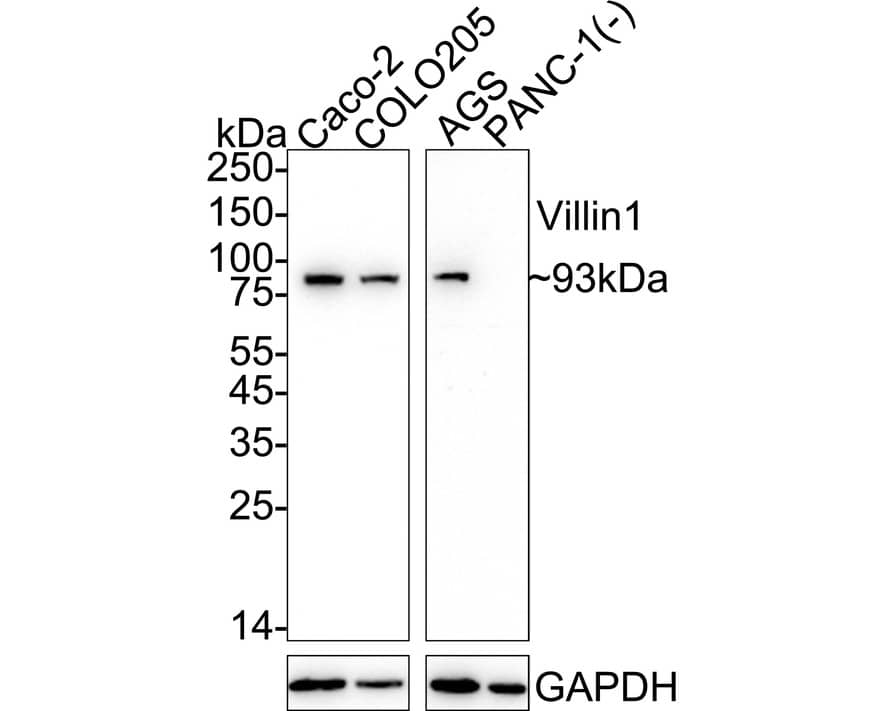 Villin 1 Antibody (JU34-75) Western Blot: Villin 1 Antibody (JU34-75) [NBP2-75707]