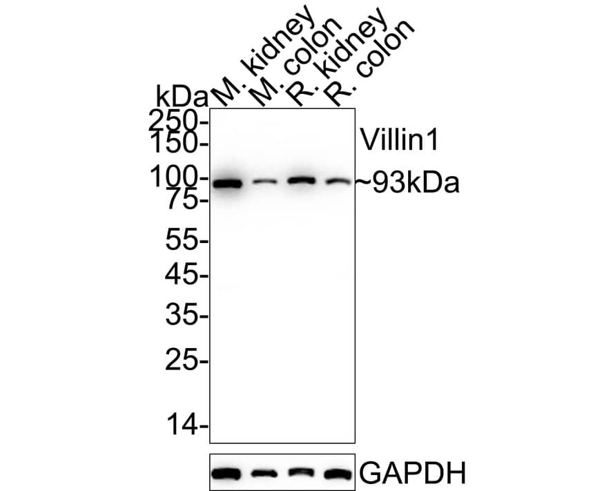 Villin 1 Antibody (JU34-75) Western Blot: Villin 1 Antibody (JU34-75) [NBP2-75707]