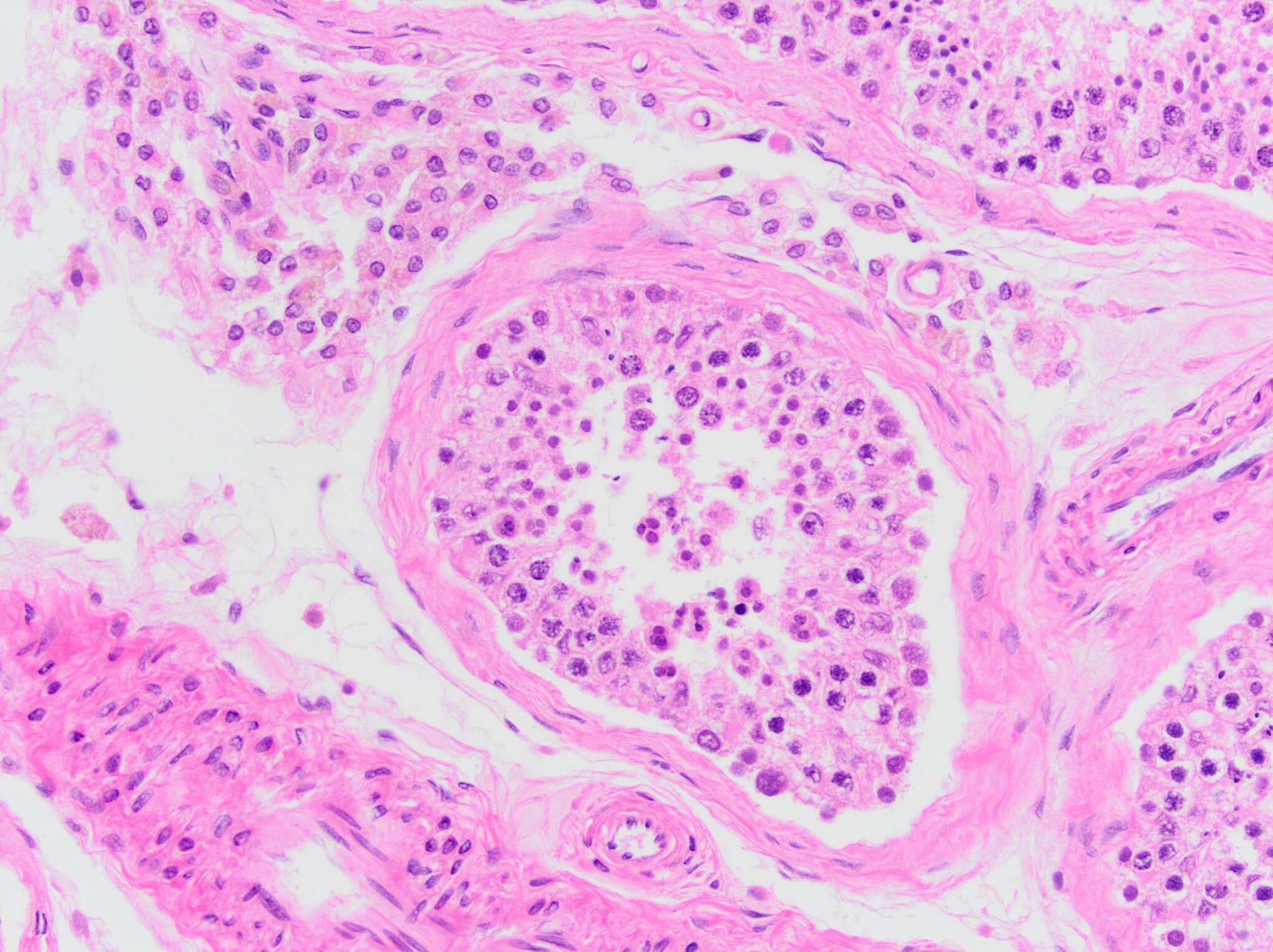 Testis Tissue Slides (Adult Normal)